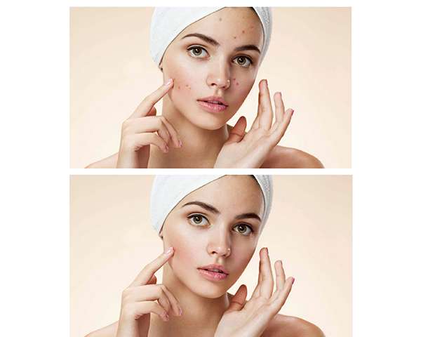 کلاس ادیت عکس