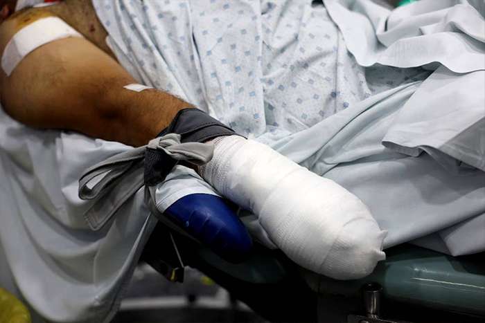 وضعیت آشفته لبنان بعد از انفجار دستگاهای پیجرها