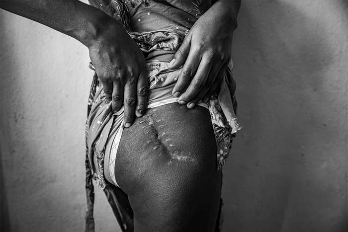 برگزیدگان مسابقه عکاسی مطبوعاتی جهان 2025