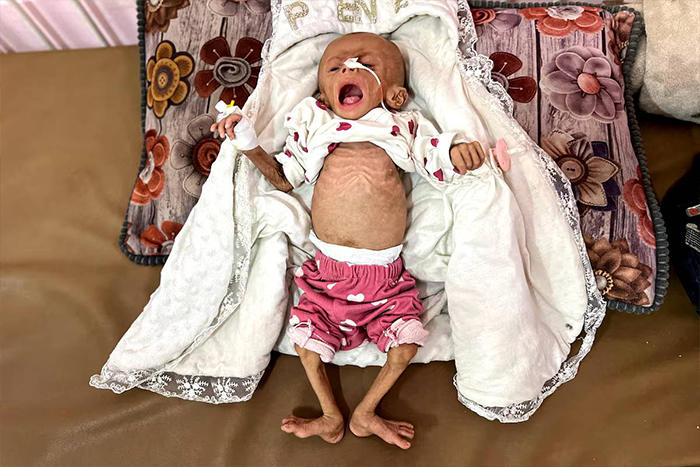 بحران گرسنگی در غزه