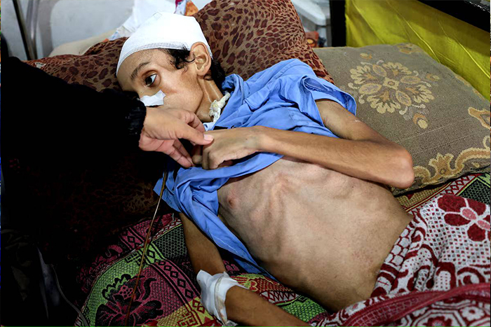 بحران گرسنگی در غزه