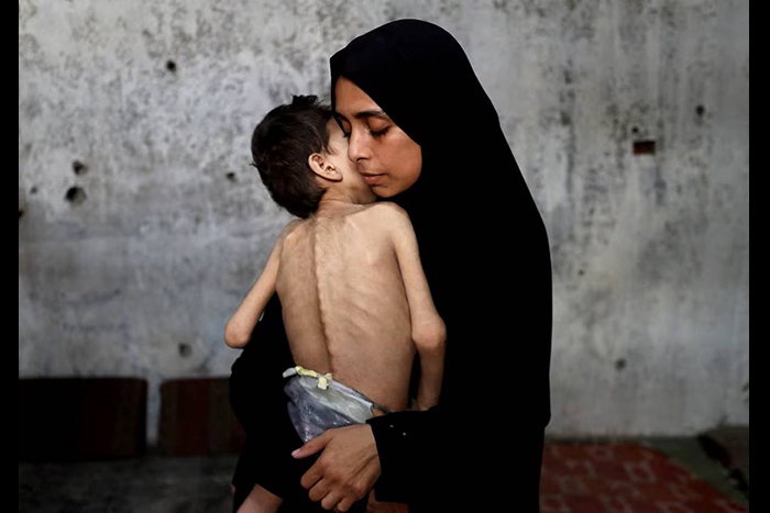 بحران گرسنگی در غزه