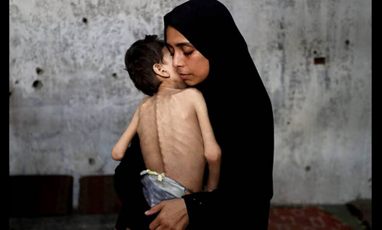 بحران گرسنگی در غزه